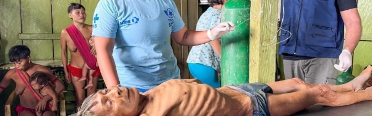 Tragédia brasileira: yanomami desnutrida recebe atendimento médico em cena chocante. (Foto: redes sociais)